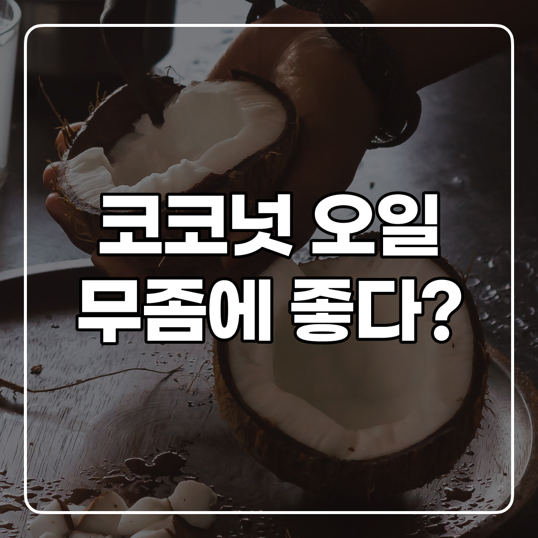코코넛 오일 무좀