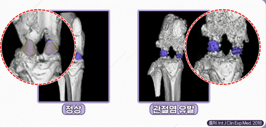 콘드로이친