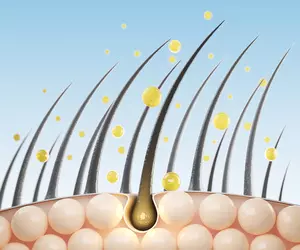 두피 가려움증 원인