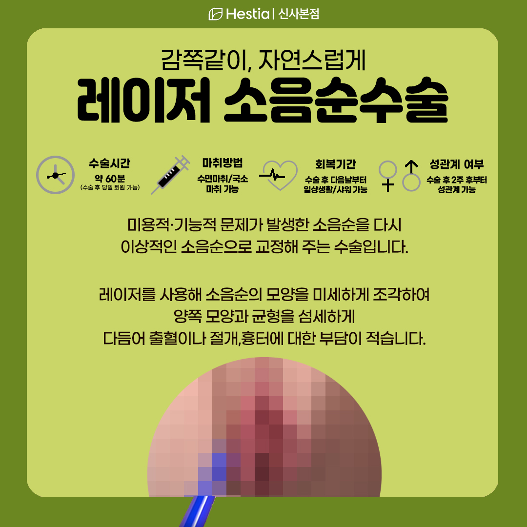 강남 소음순수술이 궁금합니다!