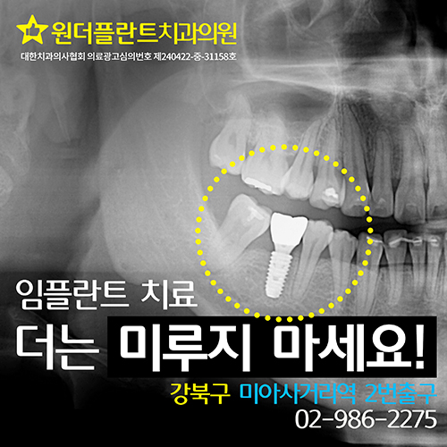 원더플란트치과의원 임플란트 치료 더는 미루지 마세요!