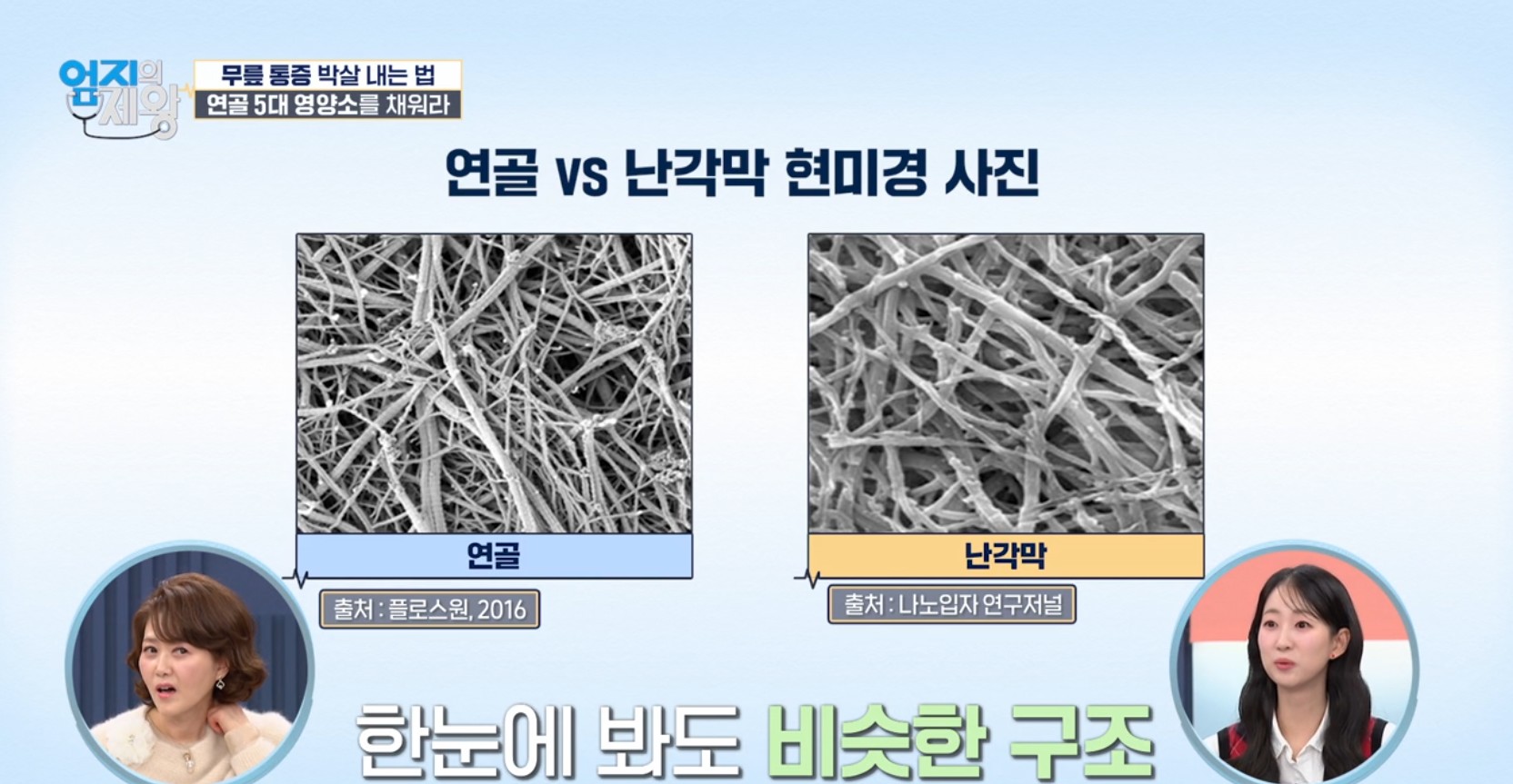 엄지의 제왕633화 무릎통증 배꼽옆 장요근 운동,연두부 레시피,난각막에 대하여