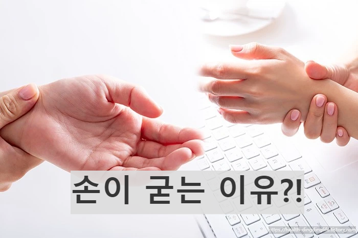 손 이미지/ 출처 - 네이버블로그 [오스틴 랩]
