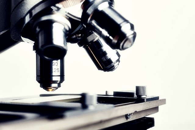 알테오젠 주가분석