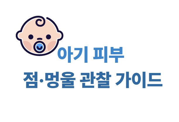 아기 피부 점, 멍울 관찰 가이드