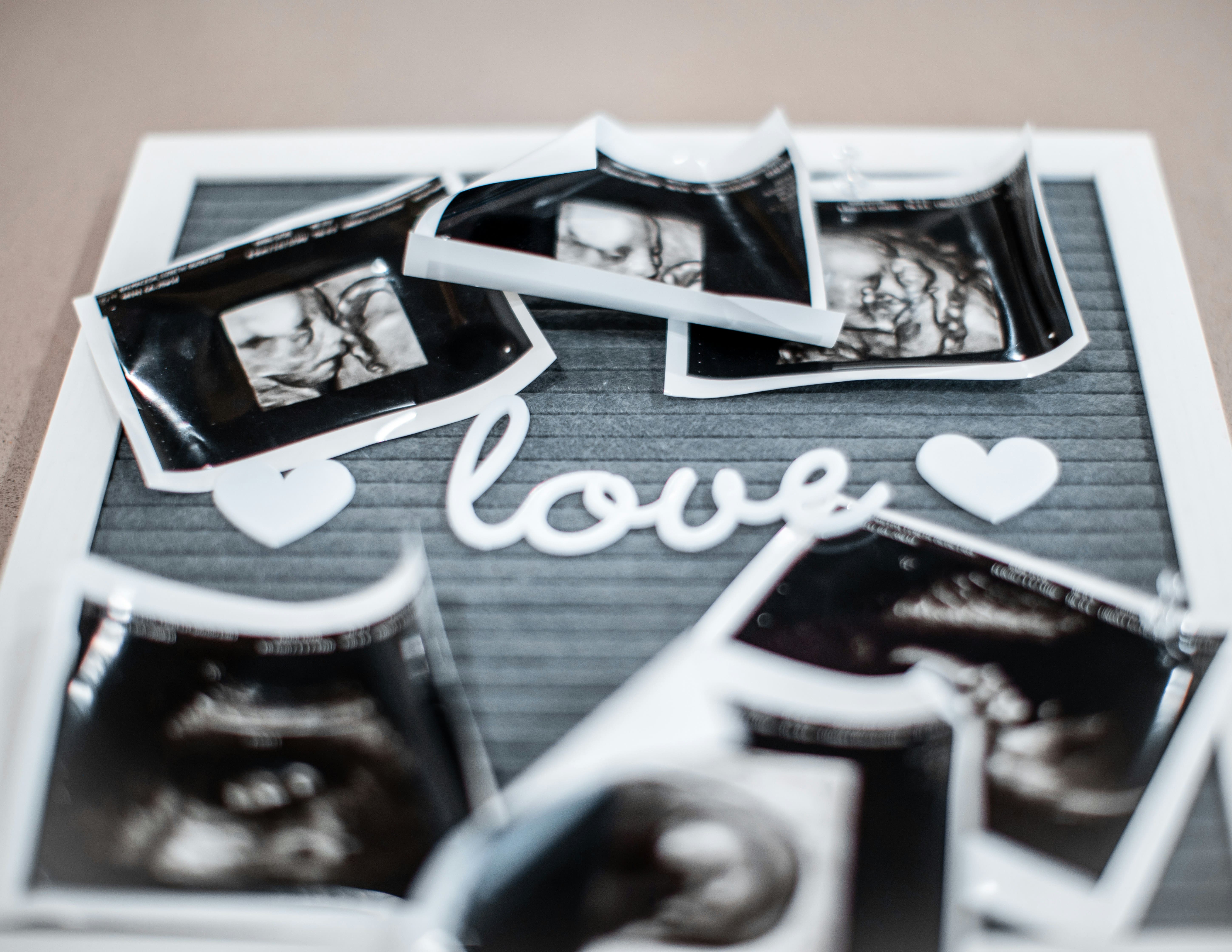 전치태반이란? 전치태반 뜻과 원인, 증상, 출산 방법 총정리