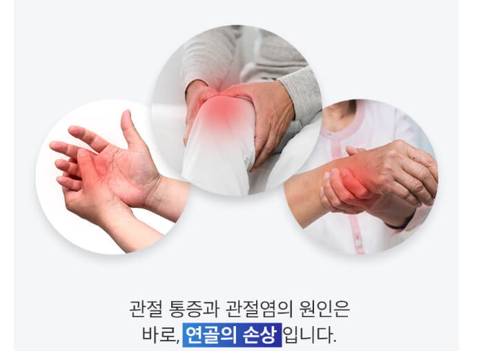 콘드로이친