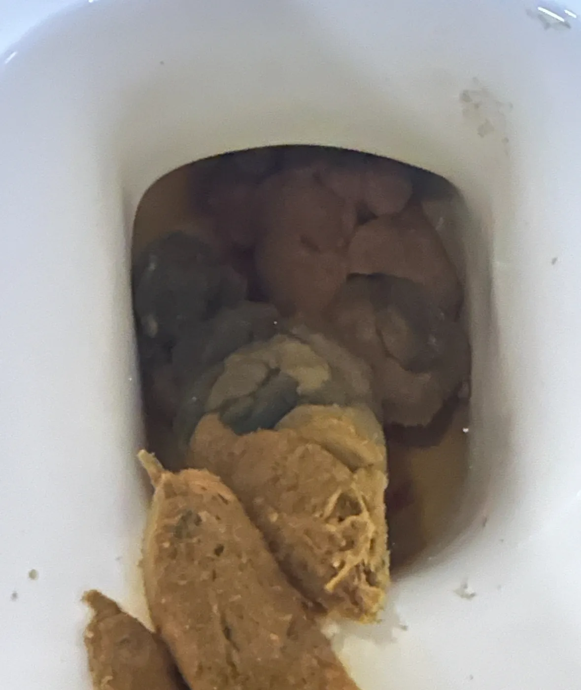 똥이 까만색 검정똥 원인과 질병 가능성_7