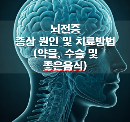 뇌전증 전조증상 원인 및 치료방법(약물, 수술 및 좋은음식