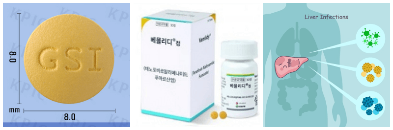 베믈리디정, B형 간염 사진