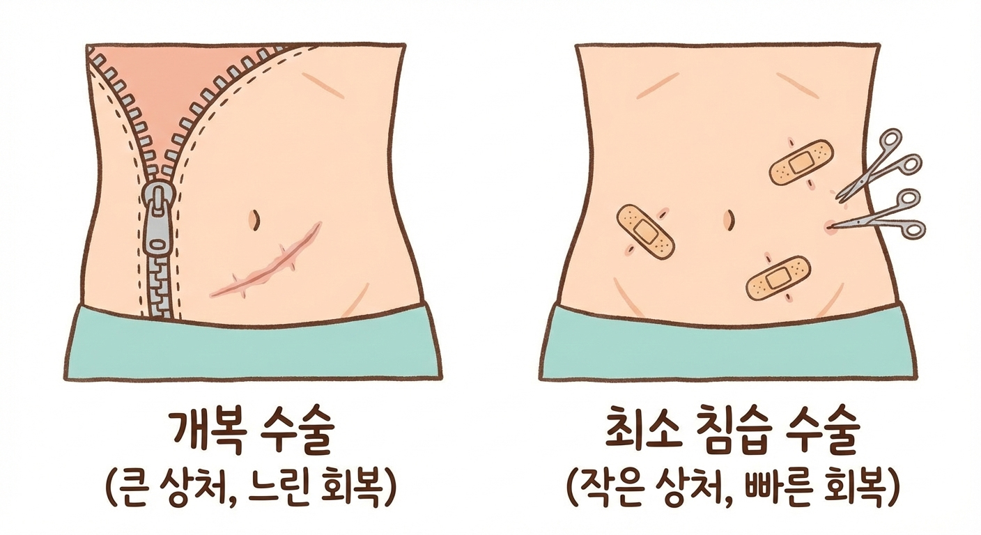 "수술만 잘 되면 끝?" 대장암 수술, 진짜 싸움은 퇴원하는 날 시작된다