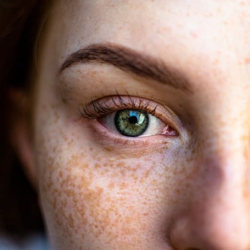 기미 없애는 방법 10가지 | 기미크림 추천 TOP4