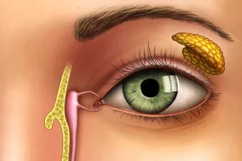 눈물샘 뚫는 수술 간단한가요에 대한 수술정보_4