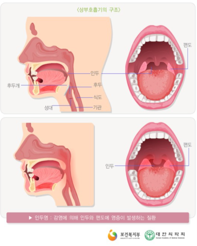 상부호흡기의구조-출처 네이버지식백과