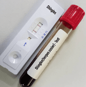 대상포진 예방접종 가격