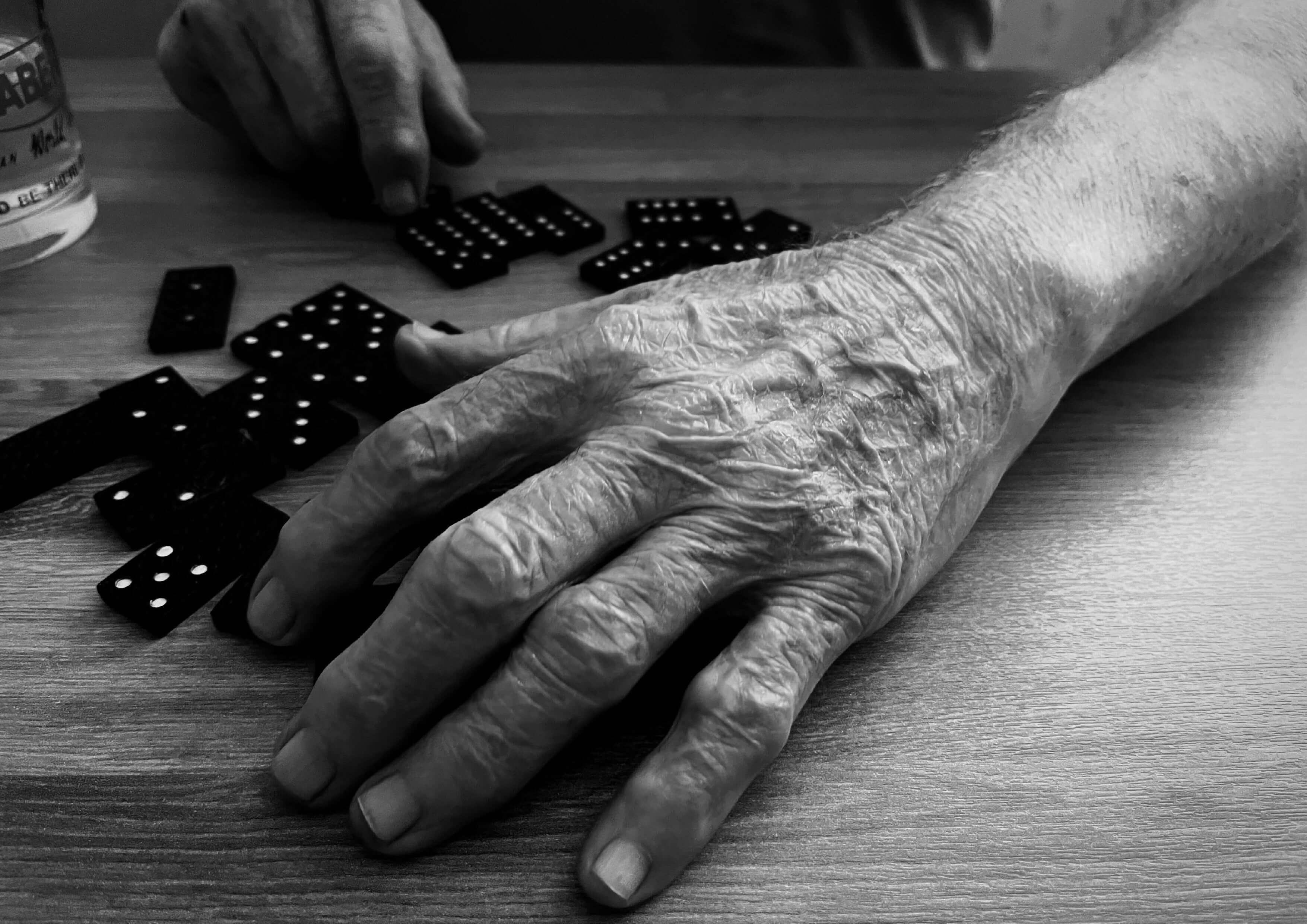 치매자가진단테스트 초기증상과 단순건망증 예방방법