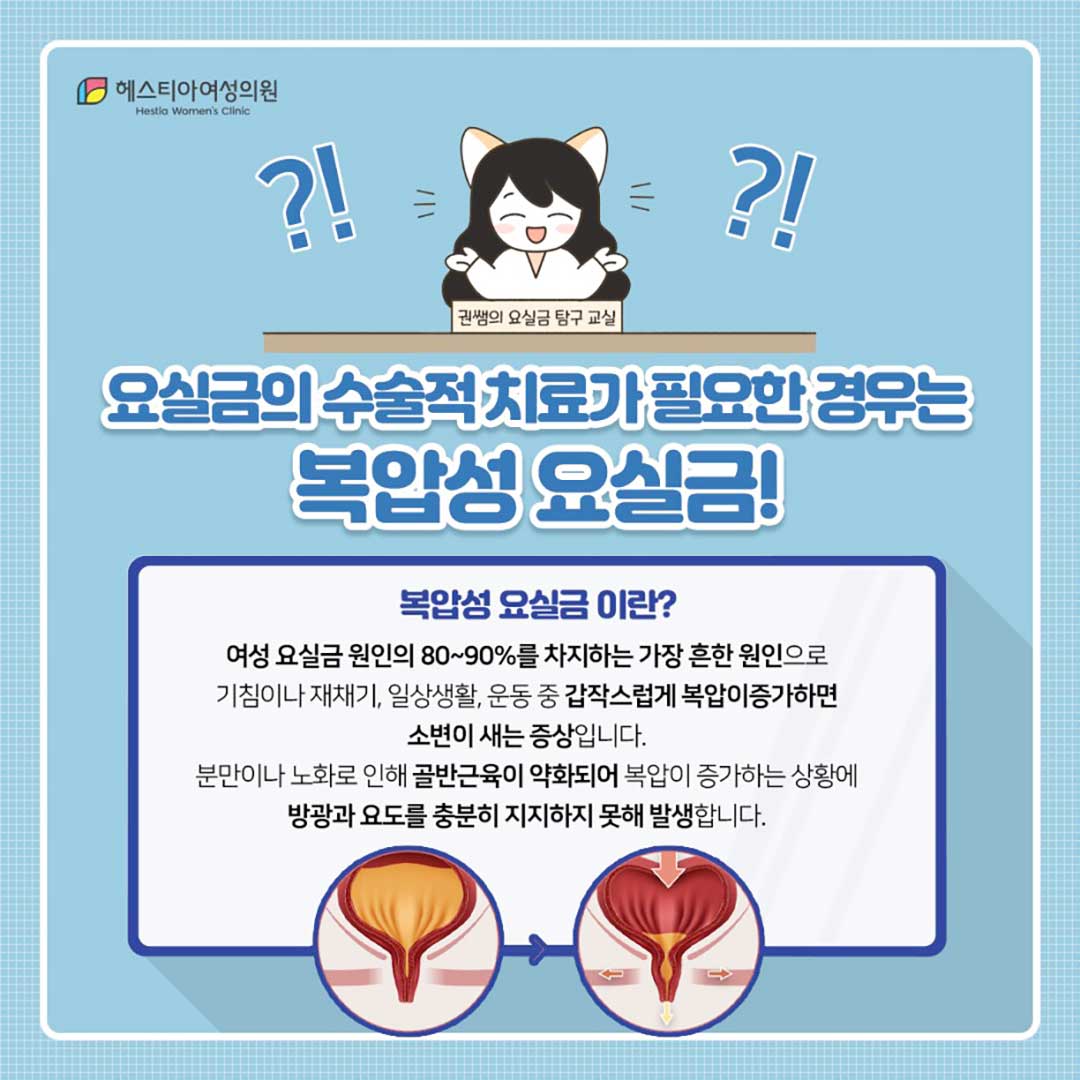복압성요실금