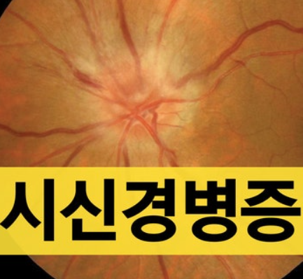 시신경 병증