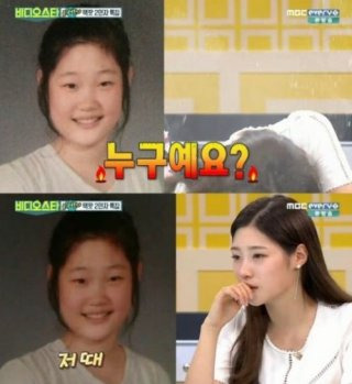 정채연 성형전 다이어트