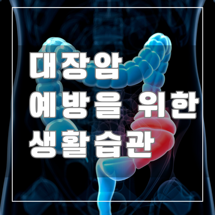 대장암 예방을 위한 생활습관