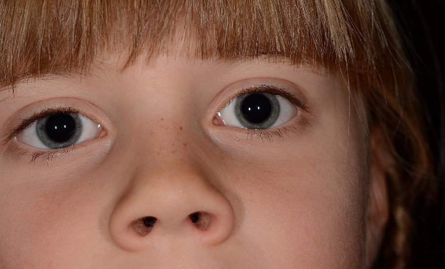 서양의 어린아이의 파란 눈과 코, 그리고 콧구멍을 확대를 하여 찍은 사진