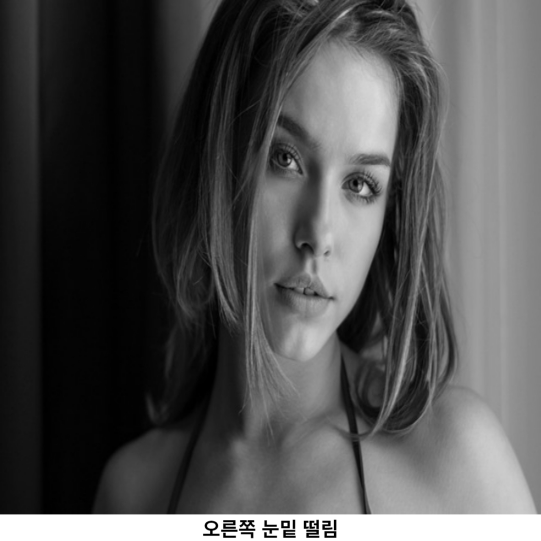 오른쪽 눈밑 떨림 / 자가진단과 해결책