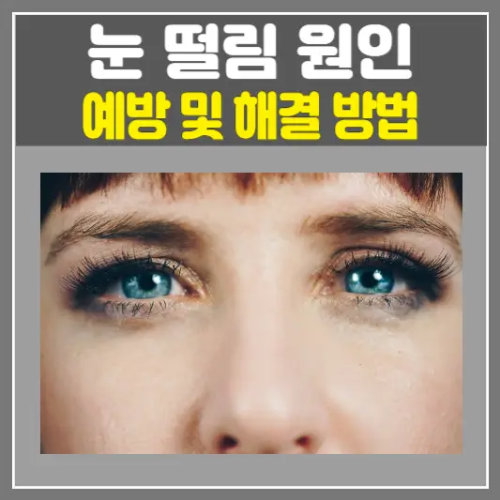 눈 떨림 원인, 예방 및 해결 방법