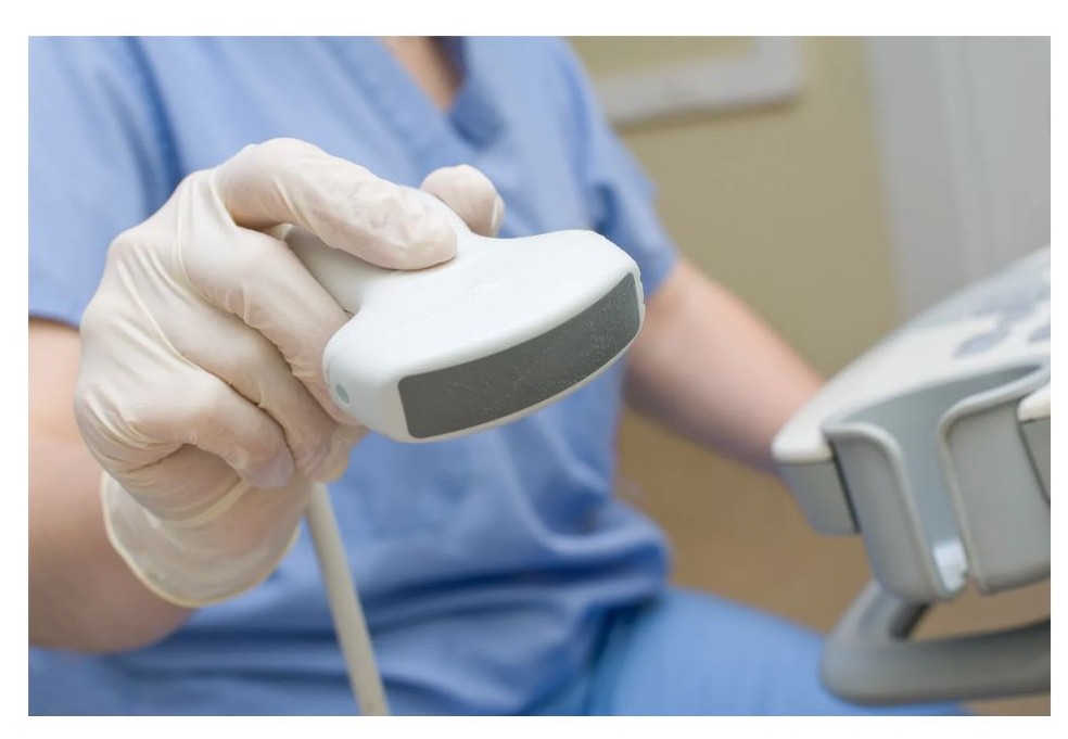 초음파 검사 기계 이미지