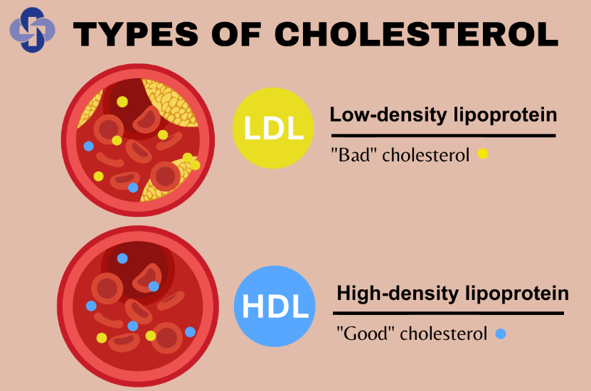 HDL 콜레스테롤&#44; LDL 콜레스테롤