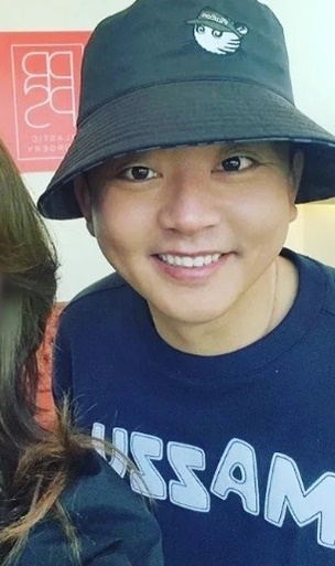 김준호 안검하수