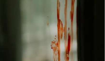 피 꿈해몽