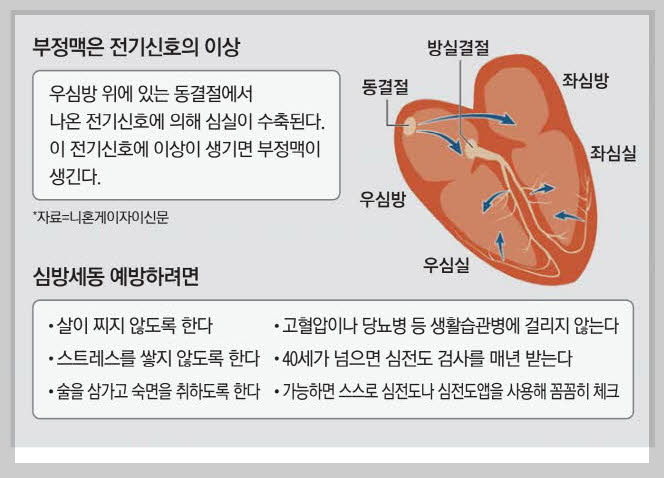 부정맥원인