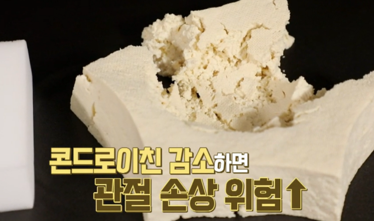 콘드로이친