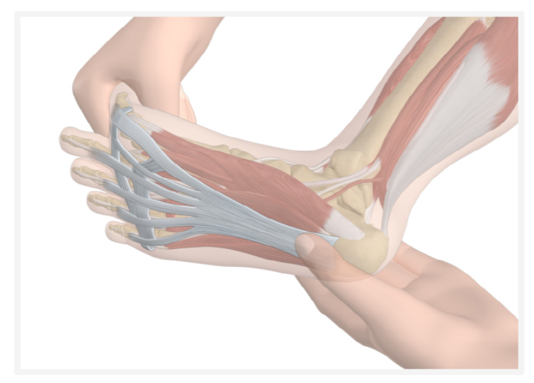 족저 근막염 자가치료