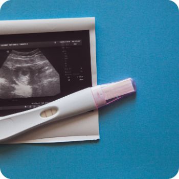 임신하는 꿈, 임신 꿈