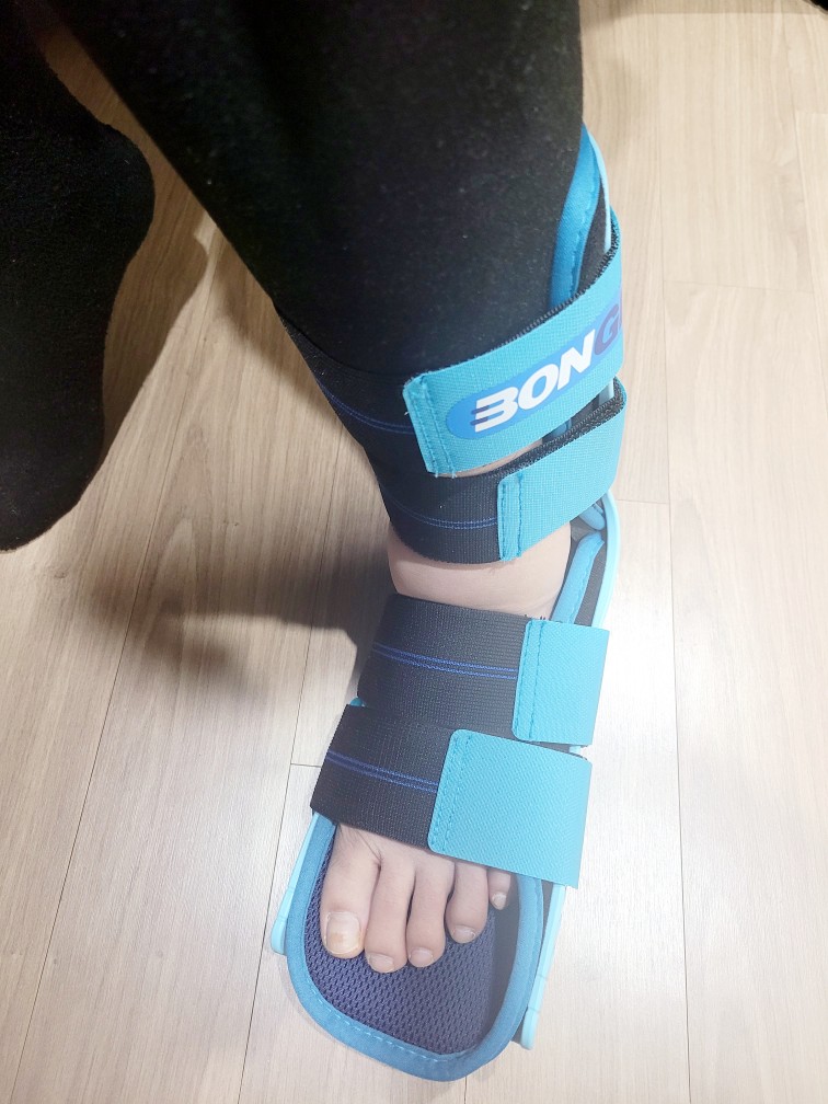 발목-접질렀을-때