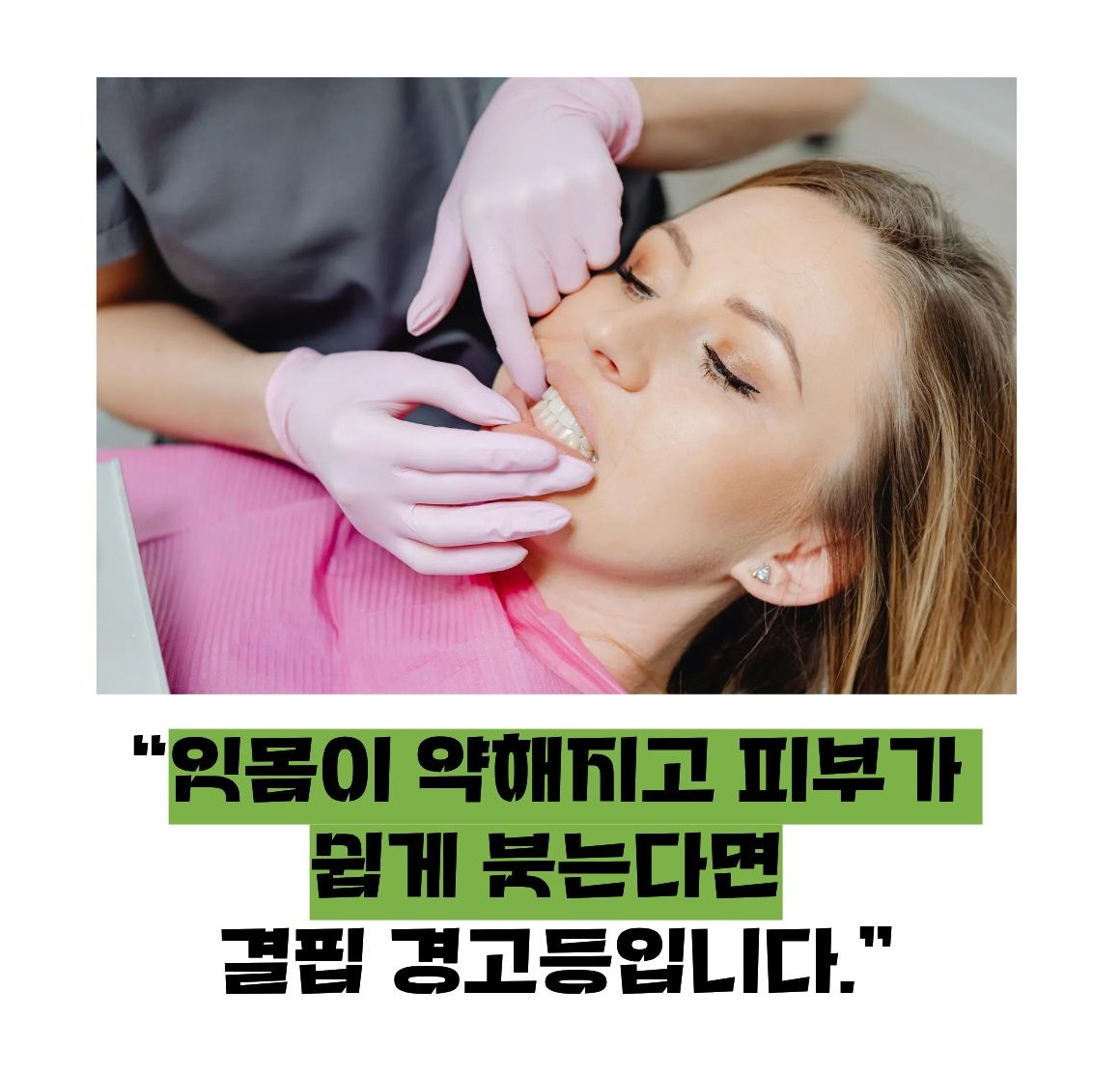 괴혈병 증세, 증상