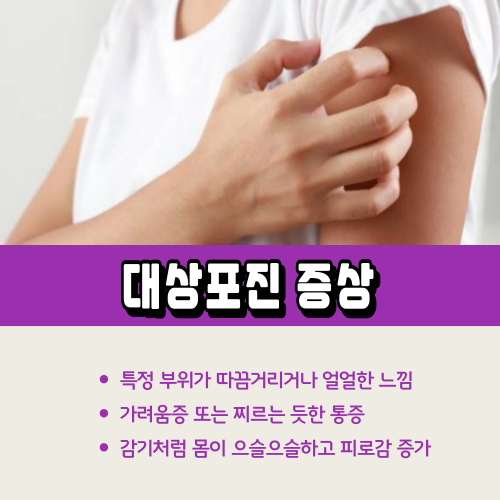 대상포진증상