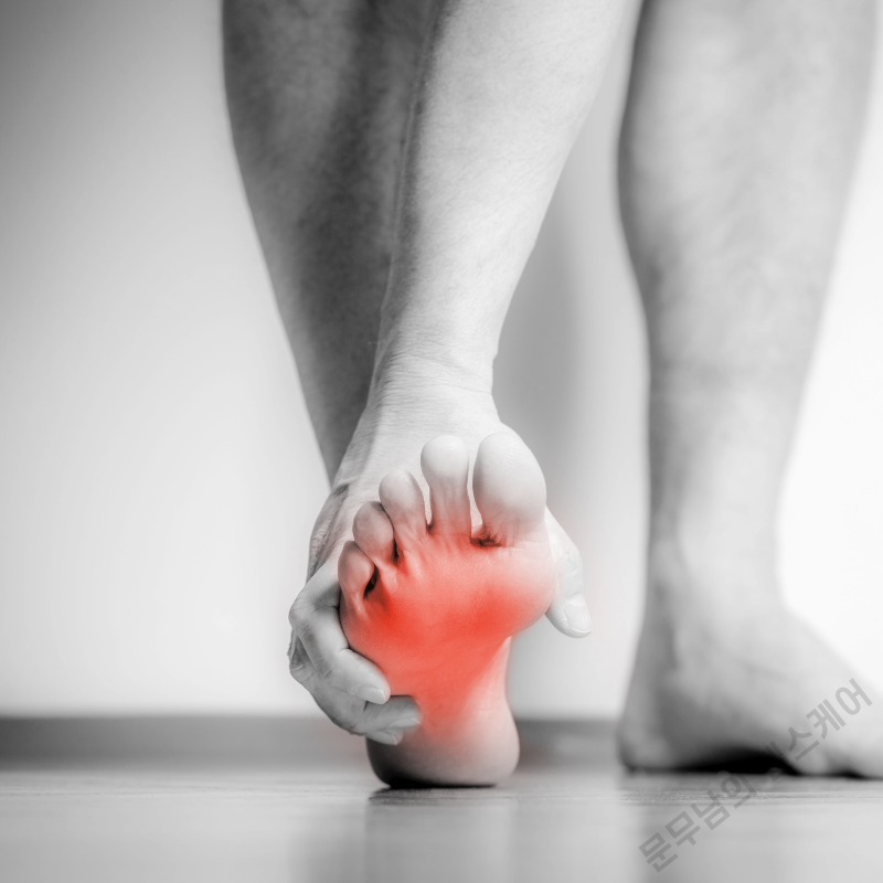 발가락 저림 증상의 원인 지간신경종