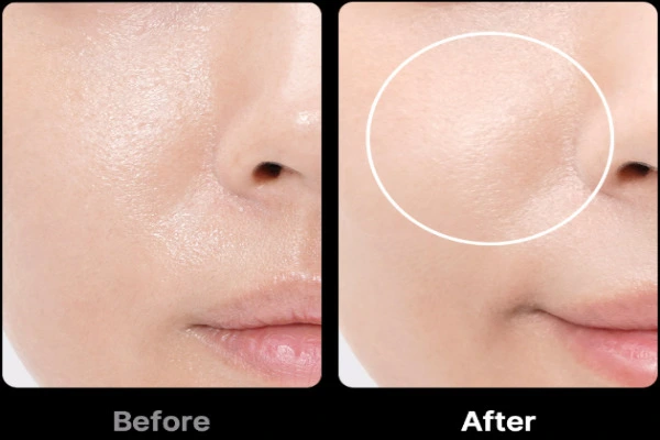 메디큐브 부스터프로 내돈내산 후기