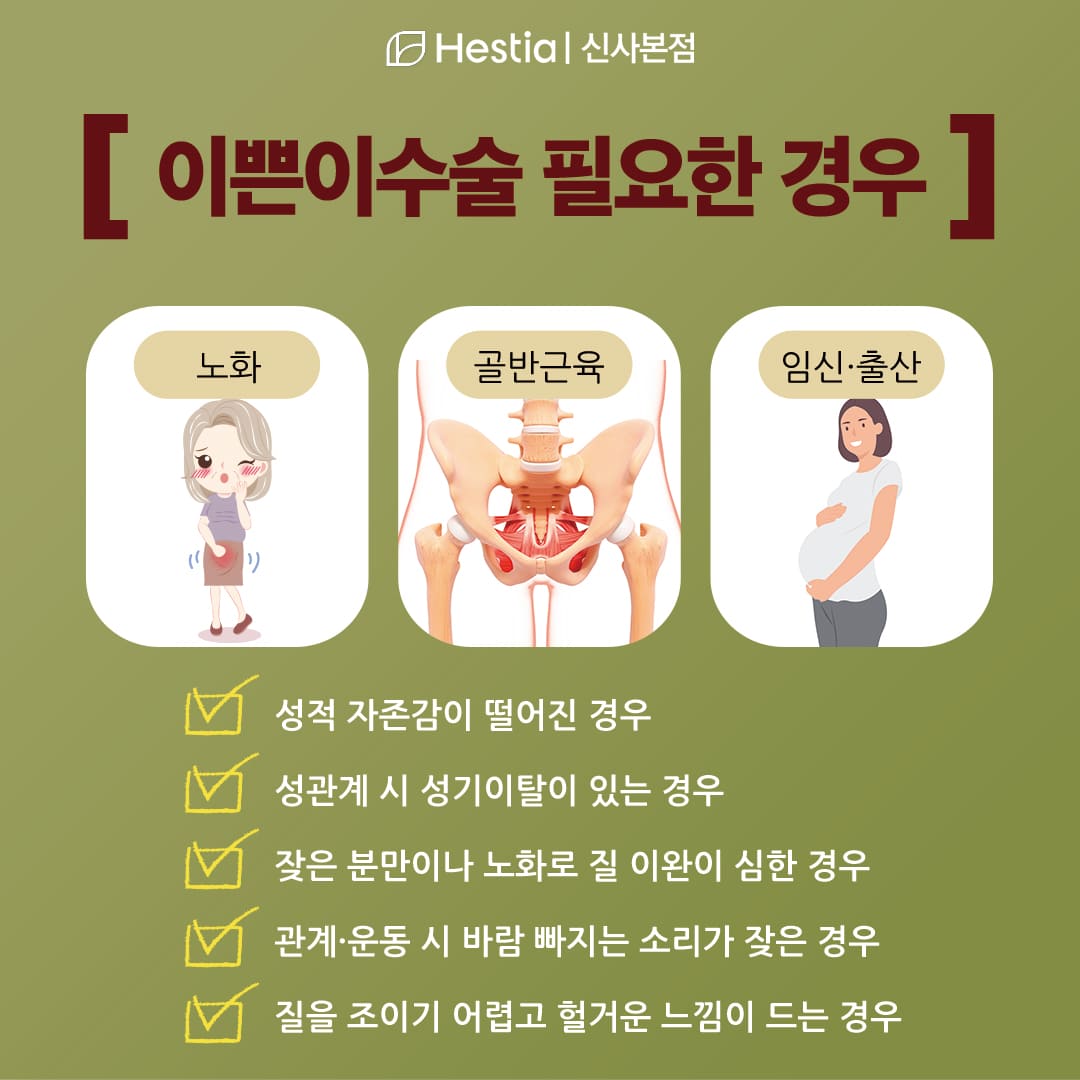 이쁜이수술이 필요한 경우?