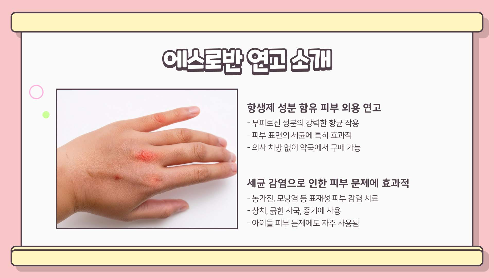 에스로반 연고 효능