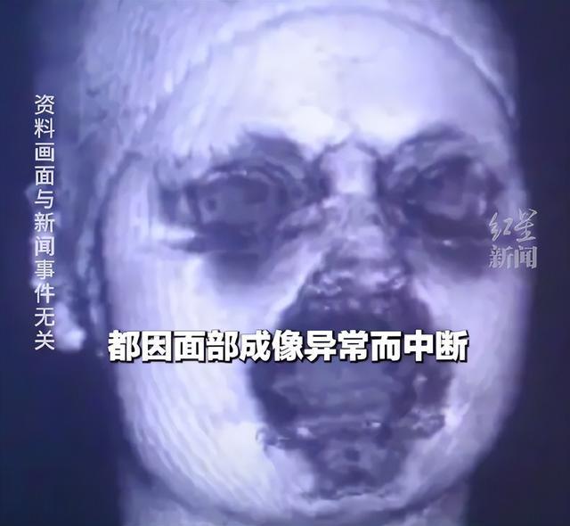 MRI 찍다가 두 번이나 화면이 까맣게?” 원인은 화장품 속 성분