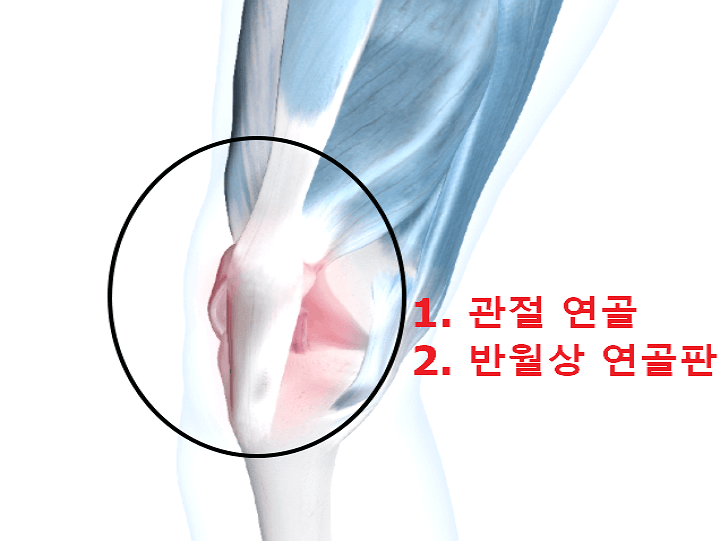 사람의 연골 사진