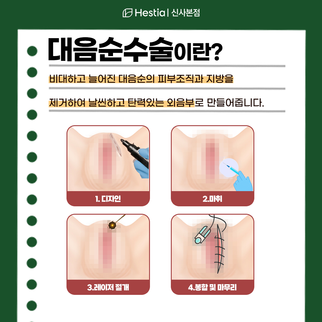 대음순성형 진행과정은?