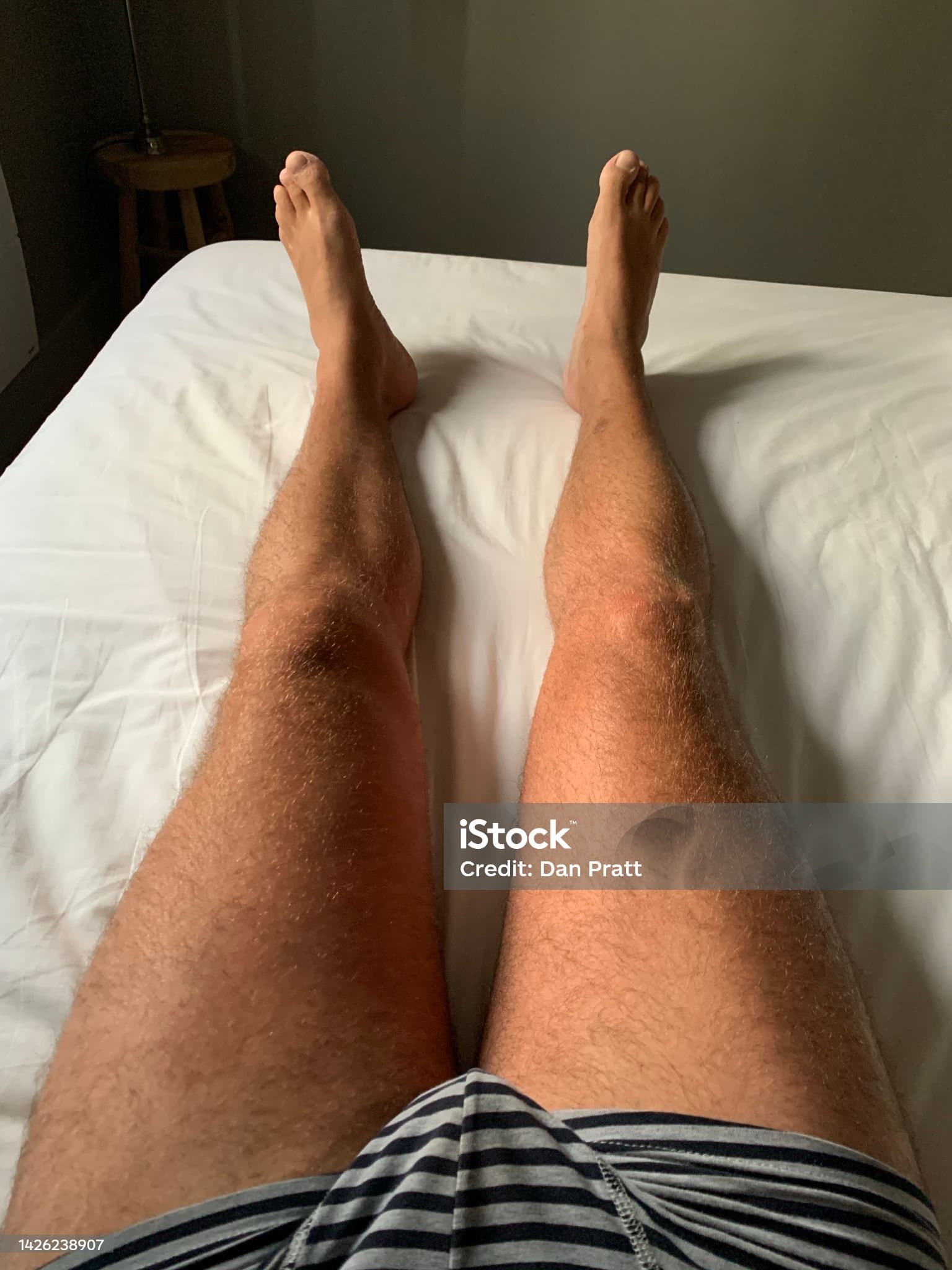 다리가 무거운 이유, 혈액순환 문제일까요?