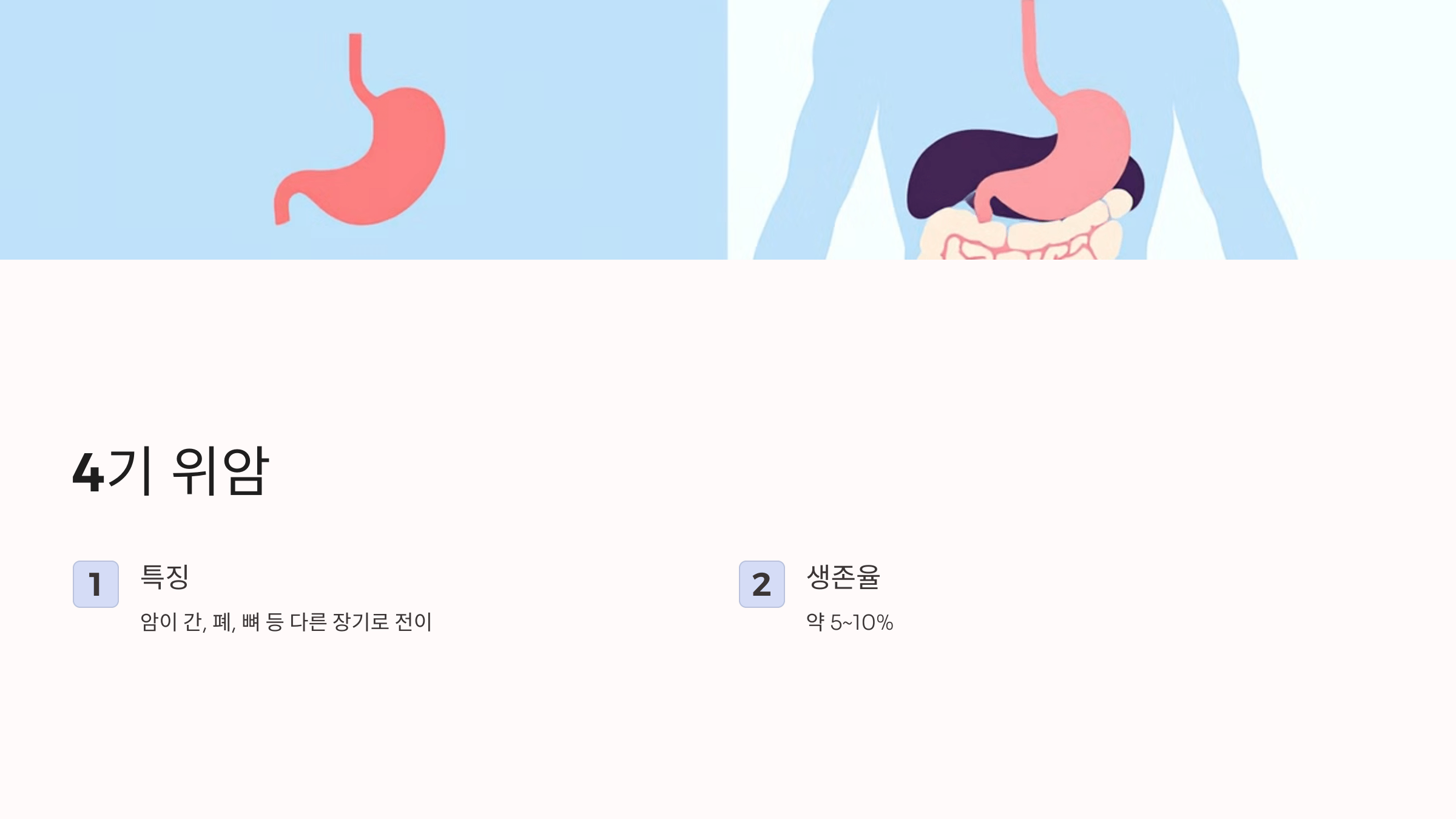 위암과 관련된 사진입니다.