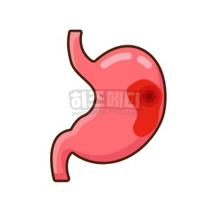 위내시경 전날 음식 금식시간