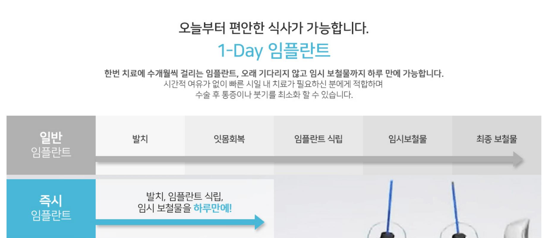 강남-크림치과-김정란원장-임플란트