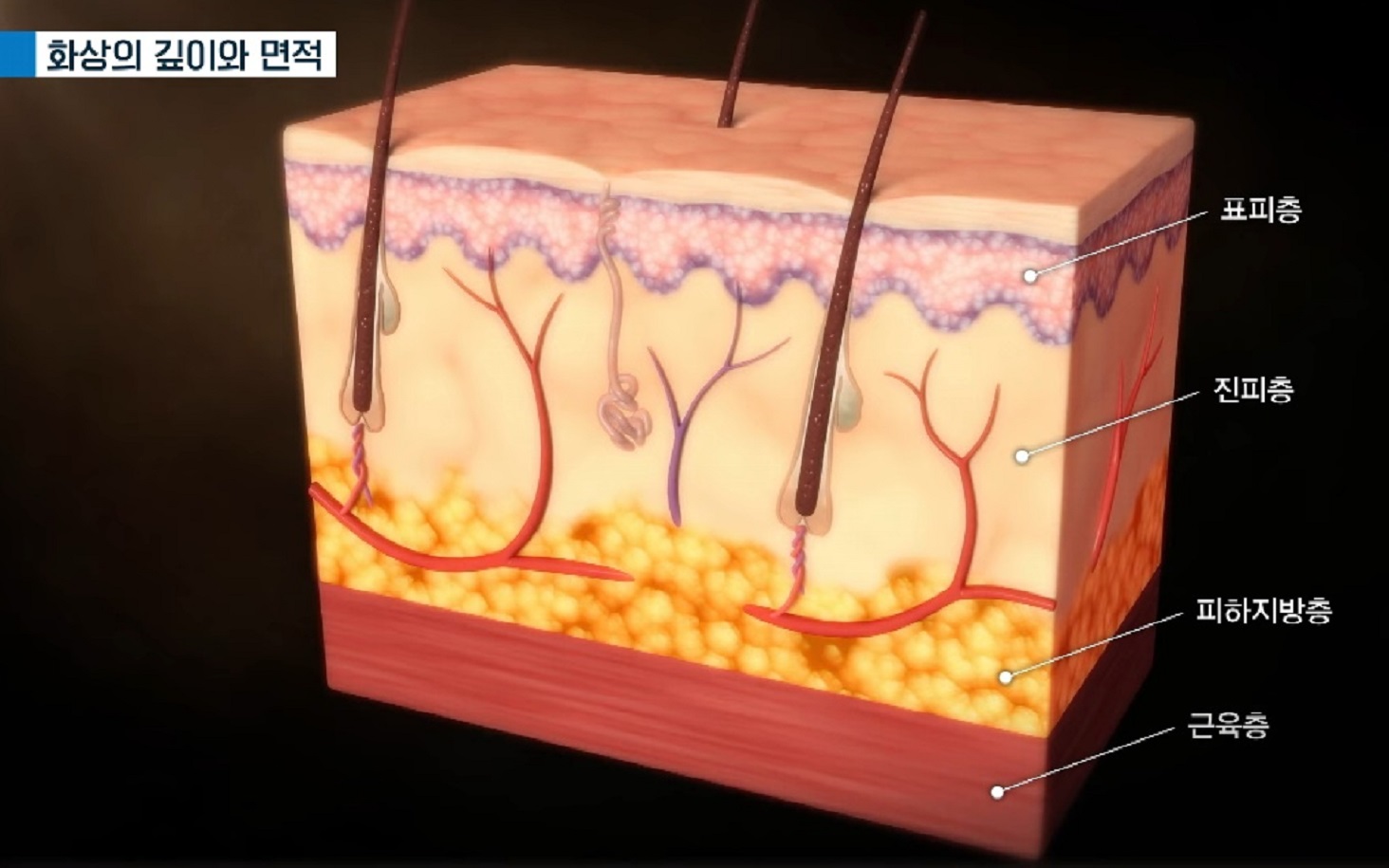 EBS명의-화상-명의